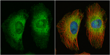 Anti-APC antibody [C3], C-term used in Immunocytochemistry/ Immunofluorescence (ICC/IF). GTX116009