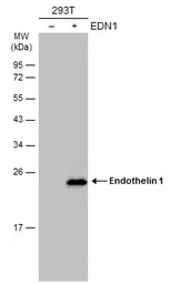 Anti-Endothelin 1 antibody [C1C3] used in Western Blot (WB). GTX116033
