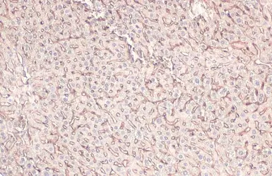 Anti-MRP1 antibody [N1N2], N-term used in IHC (Paraffin sections) (IHC-P). GTX116046