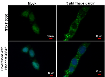 Anti-LC3B antibody [N1C3] used in Immunocytochemistry/ Immunofluorescence (ICC/IF). GTX116080