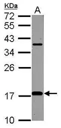 Anti-LC3B antibody [N1C3] used in Western Blot (WB). GTX116080