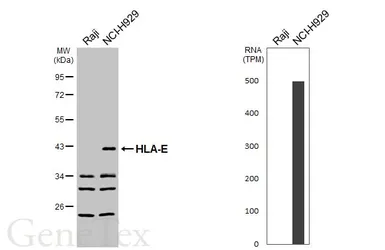 Anti-HLA-E antibody used in Western Blot (WB). GTX116088