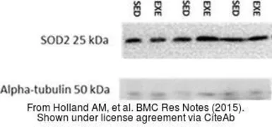Anti-SOD2 antibody used in Western Blot (WB). GTX116093