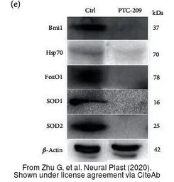 Anti-SOD2 antibody used in Western Blot (WB). GTX116093