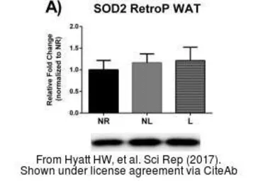Anti-SOD2 antibody used in Western Blot (WB). GTX116093