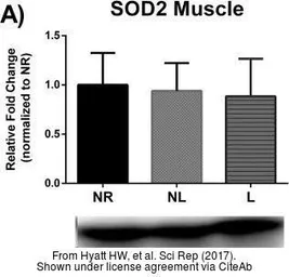 Anti-SOD2 antibody used in Western Blot (WB). GTX116093