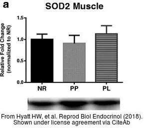 Anti-SOD2 antibody used in Western Blot (WB). GTX116093