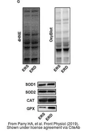 Anti-SOD2 antibody used in Western Blot (WB). GTX116093
