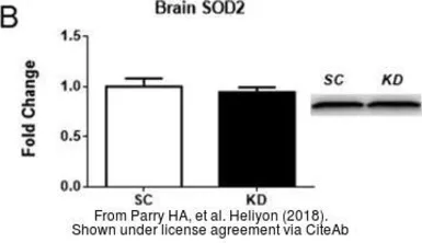 Anti-SOD2 antibody used in Western Blot (WB). GTX116093