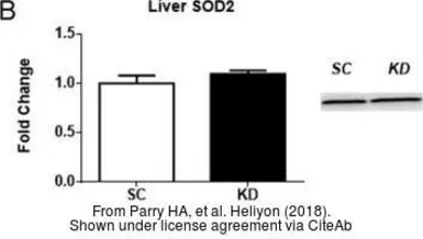 Anti-SOD2 antibody used in Western Blot (WB). GTX116093