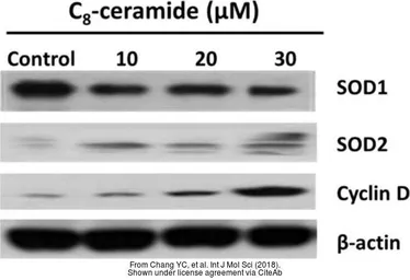 Anti-SOD2 antibody used in Western Blot (WB). GTX116093