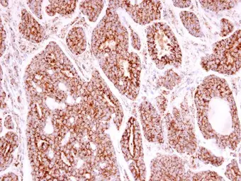 Anti-SOD2 antibody used in IHC (Paraffin sections) (IHC-P). GTX116093