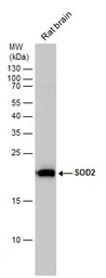 Anti-SOD2 antibody used in Western Blot (WB). GTX116093