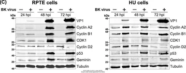 Anti-Geminin antibody used in Western Blot (WB). GTX116125