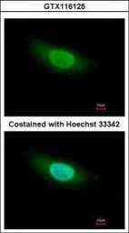 Anti-Geminin antibody used in Immunocytochemistry/ Immunofluorescence (ICC/IF). GTX116125