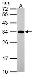 Anti-Geminin antibody used in Western Blot (WB). GTX116125