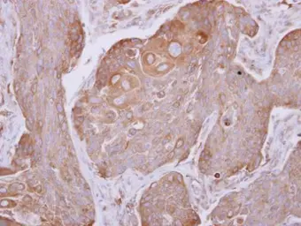 Anti-DCTN4 antibody used in IHC (Paraffin sections) (IHC-P). GTX116144