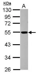 Anti-DCTN4 antibody used in Western Blot (WB). GTX116144