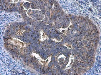 Anti-GOLPH2 antibody used in IHC (Paraffin sections) (IHC-P). GTX116154