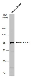 Anti-NCKIPSD antibody [C1C3] used in Western Blot (WB). GTX116172