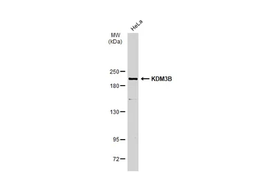 Anti-KDM3B antibody [C2C3], C-term used in Western Blot (WB). GTX116198