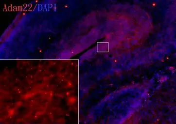 Anti-ADAM22 antibody [N1N2], N-term used in IHC (Frozen sections) (IHC-Fr). GTX116206
