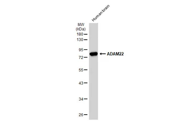 Anti-ADAM22 antibody [N1N2], N-term used in Western Blot (WB). GTX116206