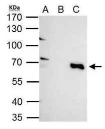Anti-TRIM25 antibody used in Immunoprecipitation (IP). GTX116209