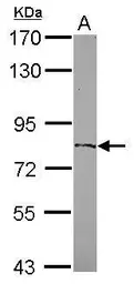 Anti-ZFP64 antibody [N1C1] used in Western Blot (WB). GTX116259