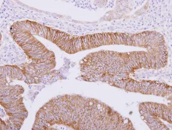 Anti-ATAD3A antibody used in IHC (Paraffin sections) (IHC-P). GTX116301