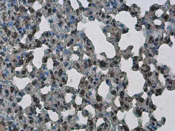 Anti-PHF10 antibody used in IHC (Paraffin sections) (IHC-P). GTX116314