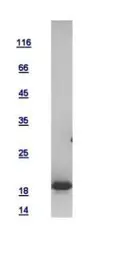 Human 4E-BP1 protein, His tag. GTX116315-pro