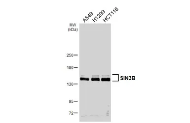 Anti-SIN3B antibody [N1N2], N-term used in Western Blot (WB). GTX116326