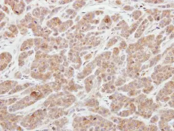 Anti-AGAP1 antibody [N1N3] used in IHC (Paraffin sections) (IHC-P). GTX116370