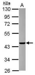 Anti-AGAP1 antibody [N1N3] used in Western Blot (WB). GTX116370