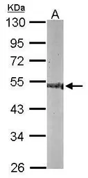 Anti-CNDP2 antibody [N3C3] used in Western Blot (WB). GTX116375