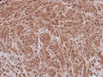 Anti-NXF3 antibody [C1C3] used in IHC (Paraffin sections) (IHC-P). GTX116398