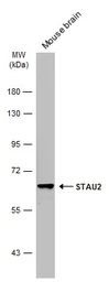 Anti-STAU2 antibody used in Western Blot (WB). GTX116458