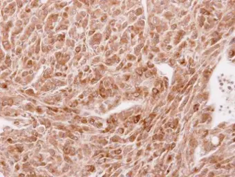 Anti-STAU2 antibody used in IHC (Paraffin sections) (IHC-P). GTX116458