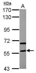 Anti-STAU2 antibody used in Western Blot (WB). GTX116458