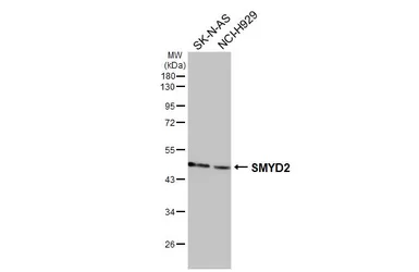 Anti-SMYD2 antibody used in Western Blot (WB). GTX116510