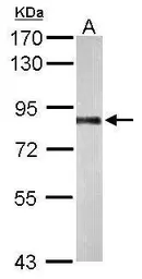 Anti-PNPase antibody used in Western Blot (WB). GTX116542