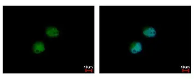 Anti-PRMT7 antibody used in Immunocytochemistry/ Immunofluorescence (ICC/IF). GTX116570
