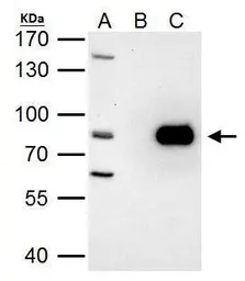 Anti-PRMT7 antibody used in Immunoprecipitation (IP). GTX116570