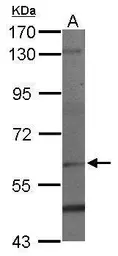 Anti-PAF1 antibody used in Western Blot (WB). GTX116580