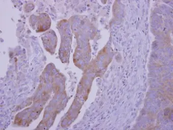 Anti-RNF23 antibody [N2C2], Internal used in IHC (Paraffin sections) (IHC-P). GTX116637