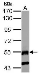 Anti-RNF23 antibody [N2C2], Internal used in Western Blot (WB). GTX116637