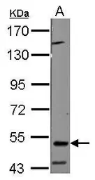 Anti-RNF23 antibody [N2C2], Internal used in Western Blot (WB). GTX116637