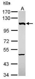 Anti-NUP107 antibody used in Western Blot (WB). GTX116664