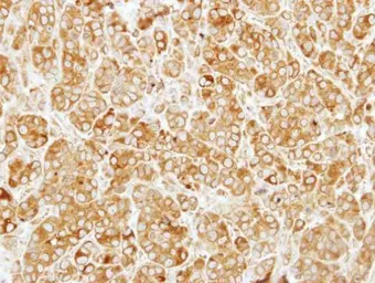 Anti-SIL1 antibody [N1N3] used in IHC (Paraffin sections) (IHC-P). GTX116755
